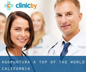 Agopuntura a Top of the World (California)